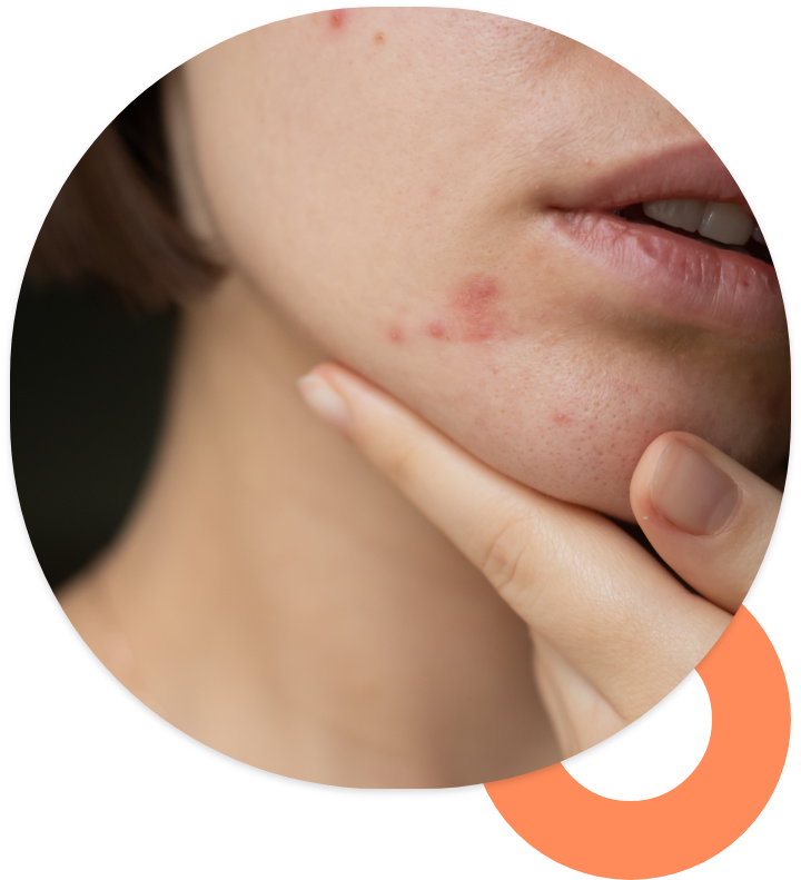 Problèmes de peau 3 problemes peau 1